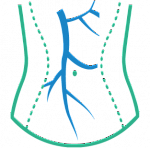 Дуплексное сканирование нижней полой вены и вен портальной системы